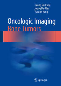 Vorderes Coverbild Oncologic Imaging: Bone Tumors