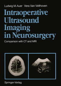 Vorderes Coverbild Intraoperative Ultrasound Imaging in Neurosurgery