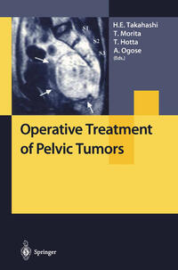 Vorderes Coverbild Operative Treatment of Pelvic Tumors