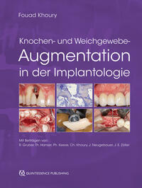 Vorderes Coverbild Knochen- und Weichgewebeaugmentation in der Implantologie