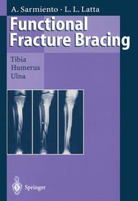 Vorderes Coverbild Functional Fracture Bracing