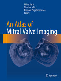 Vorderes Coverbild An Atlas of Mitral Valve Imaging