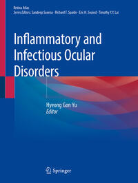 Vorderes Coverbild Inflammatory and Infectious Ocular Disorders