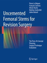 Vorderes Coverbild Uncemented Femoral Stems for Revision Surgery