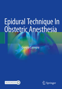 Vorderes Coverbild Epidural Technique In Obstetric Anesthesia