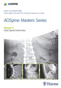 Vorderes Coverbild AOSpine Master Series, Vol. 4: Adult Spinal Deformities
