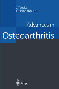 Vorderes Coverbild Advances in Osteoarthritis