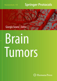 Vorderes Coverbild Brain Tumors