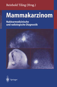 Vorderes Coverbild Mammakarzinom