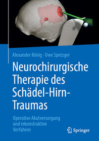 Vorderes Coverbild Neurochirurgische Therapie des Schädel-Hirn-Traumas