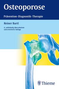 Vorderes Coverbild Osteoporose