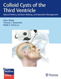 Vorderes Coverbild Colloid Cysts of the Third Ventricle