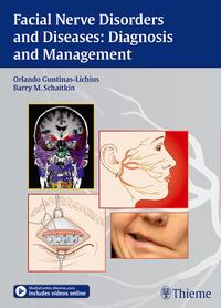 Vorderes Coverbild Facial Nerve Disorders and Diseases: Diagnosis and Management