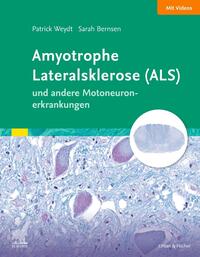 Vorderes Coverbild Amyotrophe Lateralsklerose (ALS) und andere Motoneuronerkrankungen