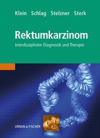 Vorderes Coverbild Das Rektumkarzinom
