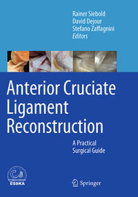 Vorderes Coverbild Anterior Cruciate Ligament Reconstruction
