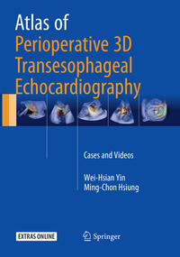 Vorderes Coverbild Atlas of Perioperative 3D Transesophageal Echocardiography