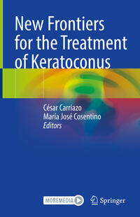 Vorderes Coverbild New Frontiers for the Treatment of Keratoconus