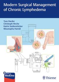 Vorderes Coverbild Modern Surgical Management of Chronic Lymphedema