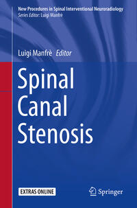 Vorderes Coverbild Spinal Canal Stenosis
