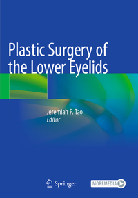 Vorderes Coverbild Plastic Surgery of the Lower Eyelids
