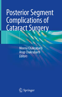 Vorderes Coverbild Posterior Segment Complications of Cataract Surgery