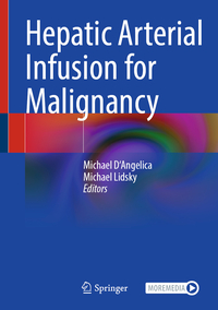 Vorderes Coverbild Hepatic Arterial Infusion for Malignancy