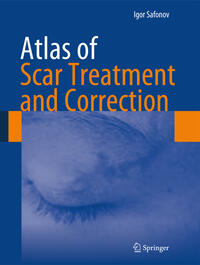 Vorderes Coverbild Atlas of Scar Treatment and Correction