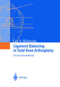 Vorderes Coverbild Ligament Balancing in Total Knee Arthroplasty