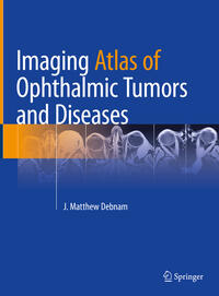 Vorderes Coverbild Imaging Atlas of Ophthalmic Tumors and Diseases