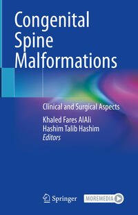 Vorderes Coverbild Congenital Spine Malformations