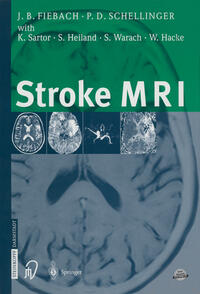 Vorderes Coverbild Stroke MRI