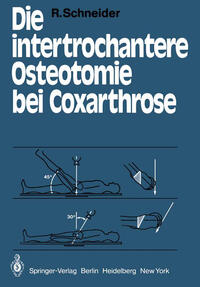 Vorderes Coverbild Die intertrochantere Osteotomie bei Coxarthrose
