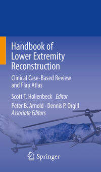 Vorderes Coverbild Handbook of Lower Extremity Reconstruction