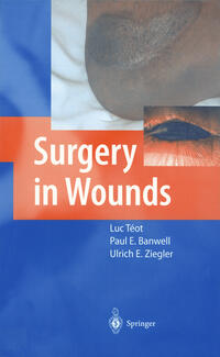 Vorderes Coverbild Surgery in Wounds