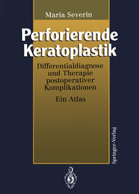 Vorderes Coverbild Perforierende Keratoplastik