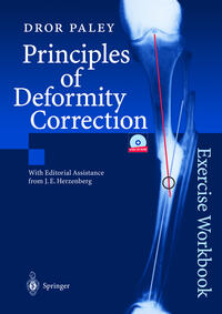 Vorderes Coverbild Principles of Deformity Correction