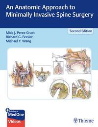 Vorderes Coverbild An Anatomic Approach to Minimally Invasive Spine Surgery