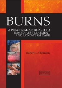 Vorderes Coverbild Burns