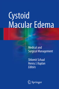 Vorderes Coverbild Cystoid Macular Edema