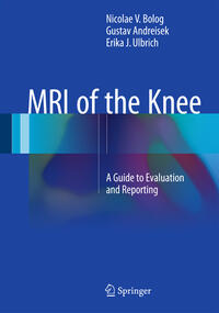 Vorderes Coverbild MRI of the Knee