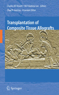 Vorderes Coverbild Transplantation of Composite Tissue Allografts