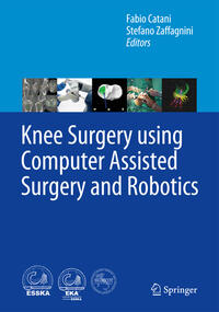 Vorderes Coverbild Knee Surgery using Computer Assisted Surgery and Robotics