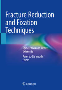 Vorderes Coverbild Fracture Reduction and Fixation Techniques