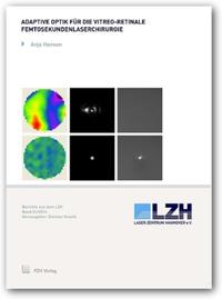 Vorderes Coverbild Adaptive Optik für die vitreo-retinale Femtosekundenlaserchirurgie