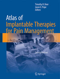 Vorderes Coverbild Atlas of Implantable Therapies for Pain Management