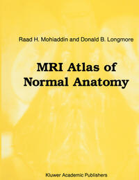 Vorderes Coverbild MRI Atlas of Normal Anatomy