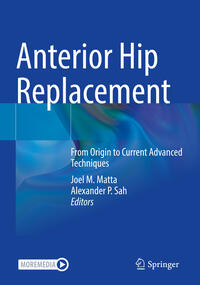 Vorderes Coverbild Anterior Hip Replacement