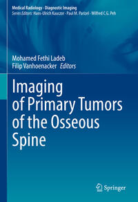 Vorderes Coverbild Imaging of Primary Tumors of the Osseous Spine