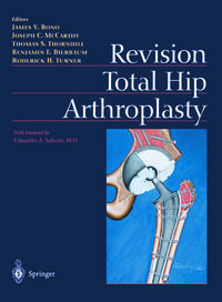 Vorderes Coverbild Revision Total Hip Arthroplasty
